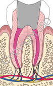 Root Canal Expert 11725
